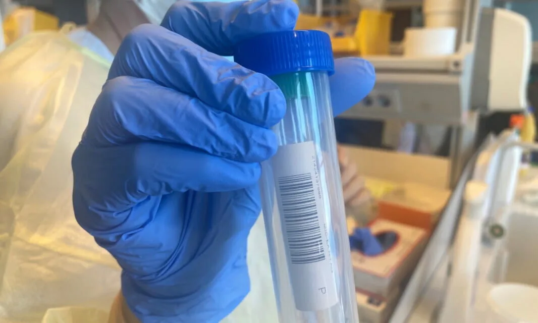 COVID-19: More than 85% of newly detected cases are people under 30 infected during leisure time