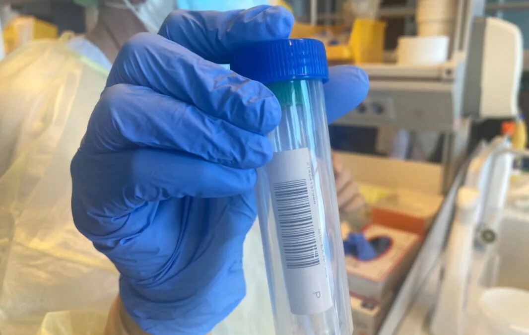 COVID-19: More than 85% of newly detected cases are people under 30 infected during leisure time