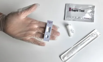EU recommend Rapid Antigen Tests for travel, President Torres celebrates “the safe reactivation of mobility and tourism in the Canary Islands”
