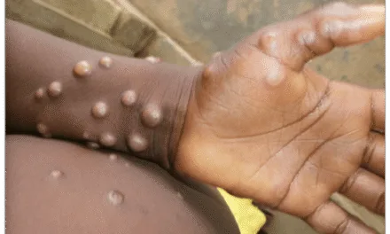 World Health Organisation working closely with countries responding to monkeypox