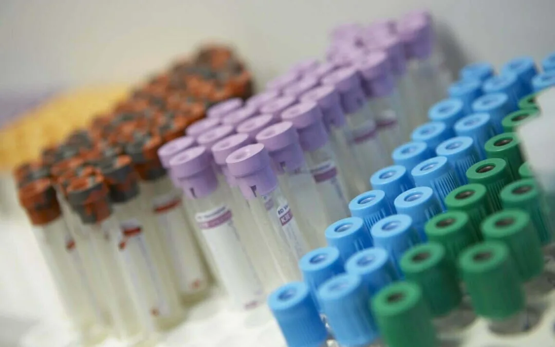 Gran Canaria confirms a monkeypox case and reports five new ones under study