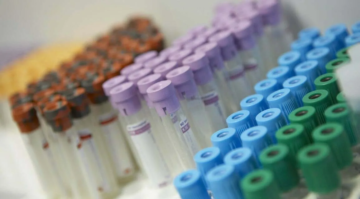 Gran Canaria confirms a monkeypox case and reports five new ones under study