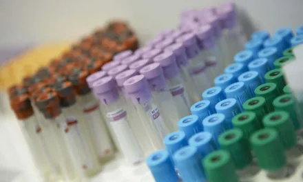Gran Canaria confirms a monkeypox case and reports five new ones under study