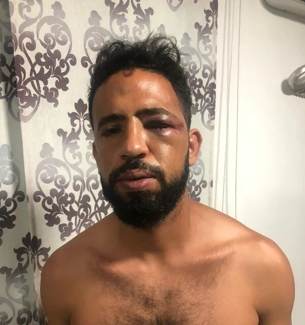 Young man alleges that he was attacked and robbed by Yumbo centre security guards